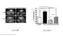Fig. 30 - Compositions and methods for treating or preventing metabolic syndrome disorders