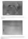 Fig. 03 - Compositions And Methods For The Treatment Of Tinnitus