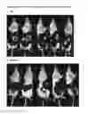 Fig. 23 - Dosing regime and formulations for type B adenovirus