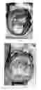 Fig. 05 - Pharmaceutical compositions for treating thermal injuries and wounds combined with bone injuries