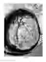 Fig. 06 - Pharmaceutical compositions for treating thermal injuries and wounds combined with bone injuries