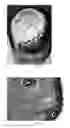 Fig. 07 - Pharmaceutical compositions for treating thermal injuries and wounds combined with bone injuries