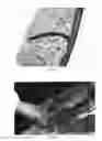 Fig. 08 - Pharmaceutical compositions for treating thermal injuries and wounds combined with bone injuries