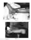 Fig. 09 - Pharmaceutical compositions for treating thermal injuries and wounds combined with bone injuries