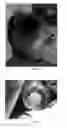 Fig. 10 - Pharmaceutical compositions for treating thermal injuries and wounds combined with bone injuries