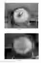 Fig. 13 - Pharmaceutical compositions for treating thermal injuries and wounds combined with bone injuries
