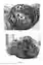Fig. 15 - Pharmaceutical compositions for treating thermal injuries and wounds combined with bone injuries
