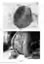 Fig. 16 - Pharmaceutical compositions for treating thermal injuries and wounds combined with bone injuries