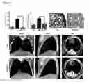 Fig. 05 - Lung injury repair compositions and methods