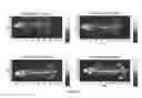 Fig. 07 - Method of identifying an agent that promotes bone growth or increases bone density