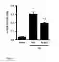 Fig. 04 - Methods and uses of slit for treating fibrosis