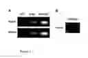 Fig. 05 - Methods and uses of slit for treating fibrosis