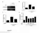 Fig. 09 - Methods and uses of slit for treating fibrosis
