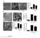 Fig. 10 - Methods and uses of slit for treating fibrosis