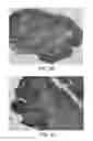 Fig. 03 - Thymic Regeneration