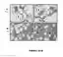 Fig. 06 - USES OF IL-12 IN HEMATOPOIETIC IMMUNOTHERAPY (HIT)