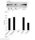 Fig. 02 - COMPOSITION OF ERYTHROCYTES ENCAPSULATING PHENYLALANINE HYDROXYLASE AND THERAPEUTIC USE THEREOF