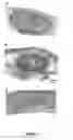 Fig. 08 - Method of treating fibrosarcoma using a nucleic acid sequence encoding APOBEC3A