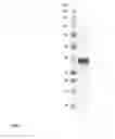 Fig. 02 - IMMUNOGENIC COMPOSITION COMPRISING NEISSERIA MENINGITIDIS MACROPHAGE INFECTIVITY POTENTIATOR PROTEIN AND METHODS FOR USING THEM