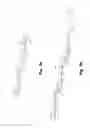 Fig. 07 - Coagulation factor VII polypeptides