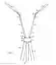 Fig. 07 - Object decontamination method using an adjustable ultravioet source