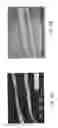 Fig. 10 - Composition, preparation, and use of chitosan shards for biomedical applications
