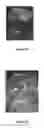 Fig. 03 - Materials and Methods for Rescue of Ischemic Tissue and Regeneration of Tissue Integrity During Resection, Engraftment and Transplantation