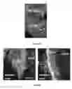 Fig. 15 - Materials and Methods for Rescue of Ischemic Tissue and Regeneration of Tissue Integrity During Resection, Engraftment and Transplantation