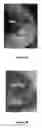 Fig. 19 - Materials and Methods for Rescue of Ischemic Tissue and Regeneration of Tissue Integrity During Resection, Engraftment and Transplantation