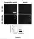 Fig. 22 - Materials and Methods for Rescue of Ischemic Tissue and Regeneration of Tissue Integrity During Resection, Engraftment and Transplantation
