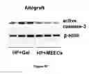 Fig. 23 - Materials and Methods for Rescue of Ischemic Tissue and Regeneration of Tissue Integrity During Resection, Engraftment and Transplantation