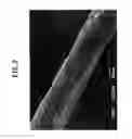 Fig. 03 - BONE DEFECT FILLING MATERIAL, AND PRODUCTION METHOD THEREFOR