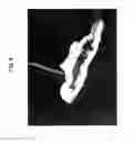 Fig. 07 - BONE DEFECT FILLING MATERIAL, AND PRODUCTION METHOD THEREFOR