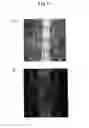 Fig. 12 - BONE DEFECT FILLING MATERIAL, AND PRODUCTION METHOD THEREFOR