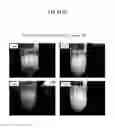 Fig. 16 - BONE DEFECT FILLING MATERIAL, AND PRODUCTION METHOD THEREFOR