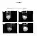Fig. 19 - BONE DEFECT FILLING MATERIAL, AND PRODUCTION METHOD THEREFOR