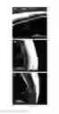 Fig. 11 - Formulations for Tailored Drug Release
