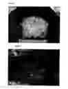 Fig. 05 - Antiadhesive Kit and Method of Adhesion Prevention