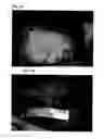 Fig. 06 - Antiadhesive Kit and Method of Adhesion Prevention