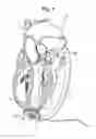Fig. 02 - Bearing for a cardiac pump
