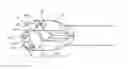 Fig. 01 - Split-tip catheter including lateral distal openings