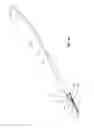 Fig. 10 - Split-tip catheter including lateral distal openings