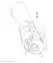 Fig. 17 - Split-tip catheter including lateral distal openings