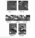 Fig. 05 - INJECTOR FOR INTRAOCULAR INJECTION