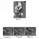 Fig. 06 - INJECTOR FOR INTRAOCULAR INJECTION