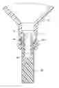 Fig. 01 - Sterility enhanced closure for a fluid path