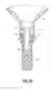Fig. 07 - Sterility enhanced closure for a fluid path