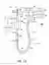Fig. 02 - Fluid input module for multi-lumen catheters