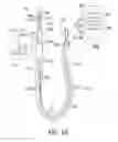 Fig. 03 - Fluid input module for multi-lumen catheters