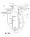 Fig. 05 - Fluid input module for multi-lumen catheters